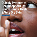Cetaphil Multi-Purpose Healing Ointment for Dry, Cracked Skin and Chapped Lips with Shea Butter and Vitamin E - 12oz